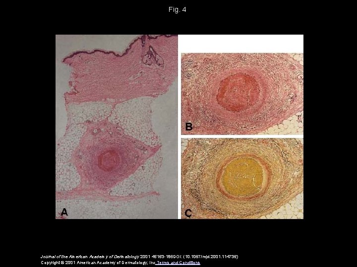 Fig. 4 Journal of the American Academy of Dermatology 2001 45163 -186 DOI: (10.