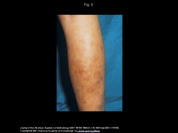 Fig. 5 Journal of the American Academy of Dermatology 2001 45163 -186 DOI: (10.