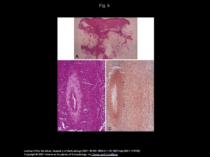 Fig. 6 Journal of the American Academy of Dermatology 2001 45163 -186 DOI: (10.