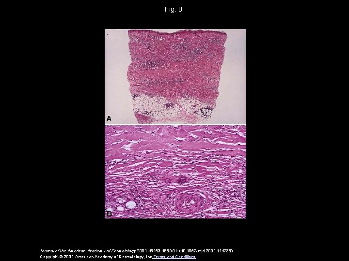 Fig. 8 Journal of the American Academy of Dermatology 2001 45163 -186 DOI: (10.