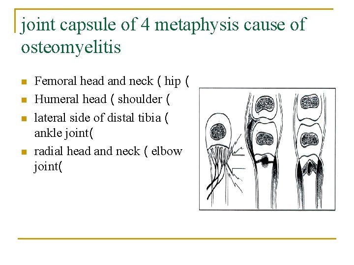joint capsule of 4 metaphysis cause of osteomyelitis n n Femoral head and neck