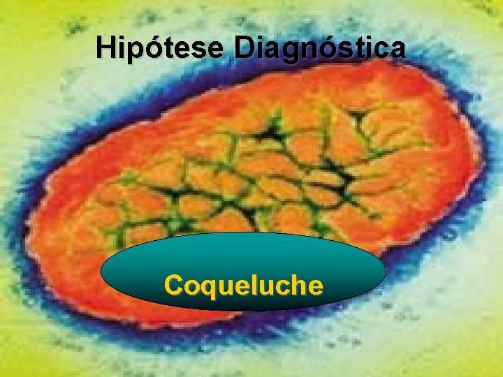 Hipótese Diagnóstica Coqueluche 