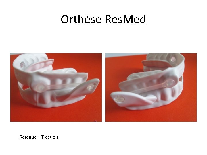 Orthèse Res. Med Retenue - Traction 