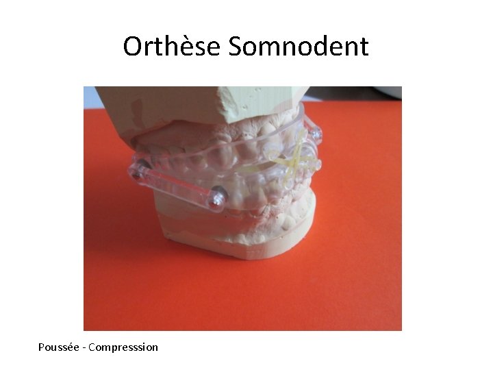 Orthèse Somnodent Poussée - Compresssion 
