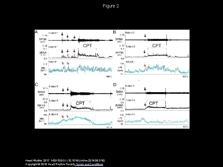 Figure 2 Heart Rhythm 2017 1425 -33 DOI: (10. 1016/j. hrthm. 2016. 09. 019)