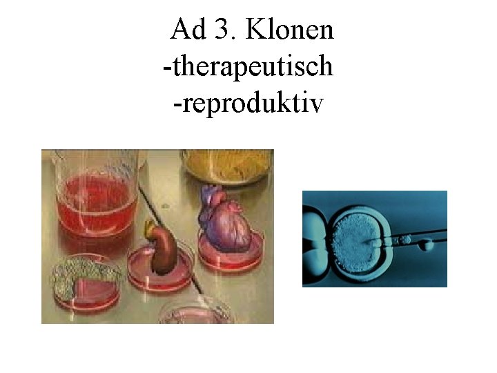 Ad 3. Klonen -therapeutisch -reproduktiv 