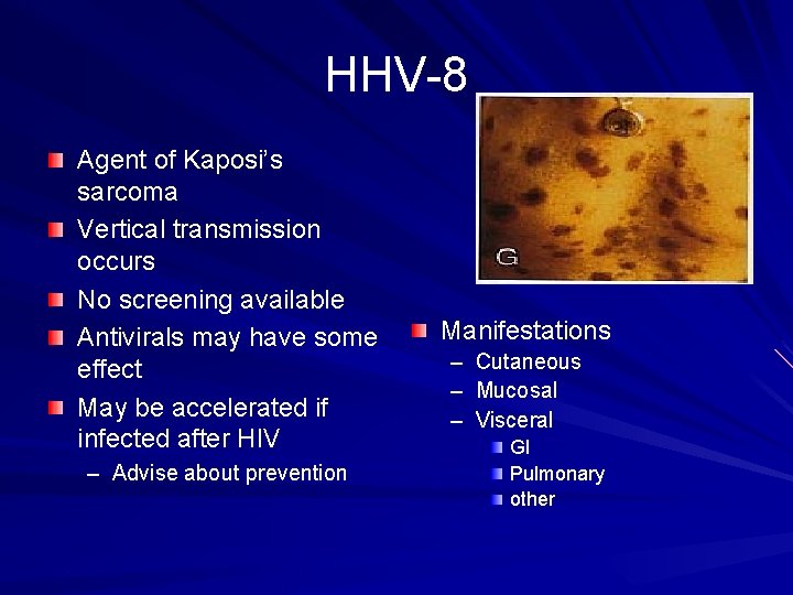 HHV-8 Agent of Kaposi’s sarcoma Vertical transmission occurs No screening available Antivirals may have