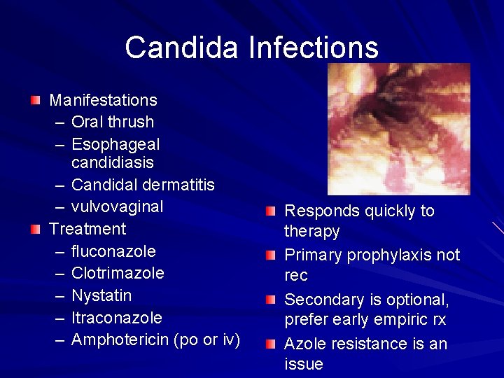 Candida Infections Manifestations – Oral thrush – Esophageal candidiasis – Candidal dermatitis – vulvovaginal