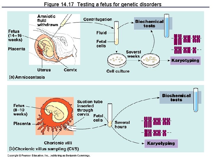 Figure 14. 17 Testing a fetus for genetic disorders 