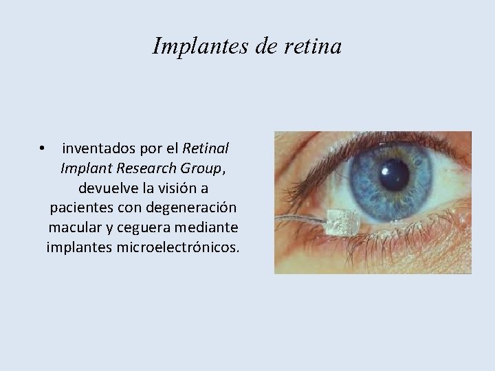 Implantes de retina • inventados por el Retinal Implant Research Group, devuelve la visión