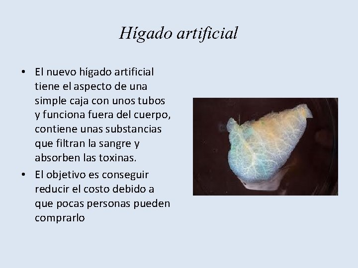 Hígado artificial • El nuevo hígado artificial tiene el aspecto de una simple caja