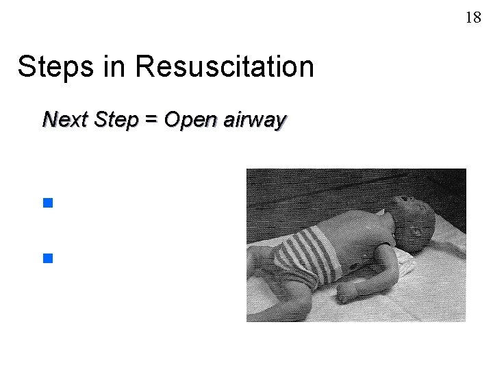 18 Steps in Resuscitation Next Step = Open airway n n 