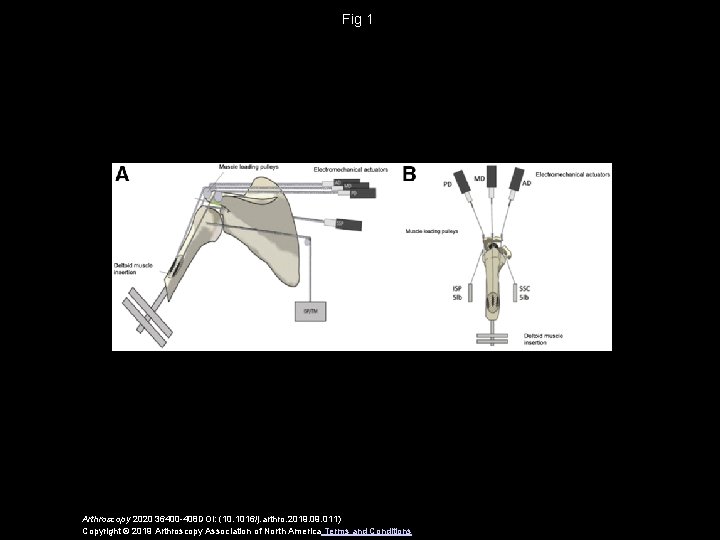 Fig 1 Arthroscopy 2020 36400 -408 DOI: (10. 1016/j. arthro. 2019. 011) Copyright ©