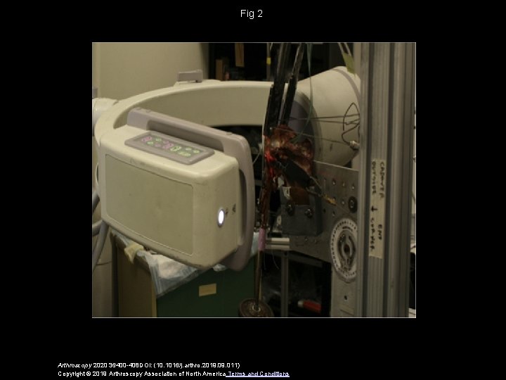 Fig 2 Arthroscopy 2020 36400 -408 DOI: (10. 1016/j. arthro. 2019. 011) Copyright ©