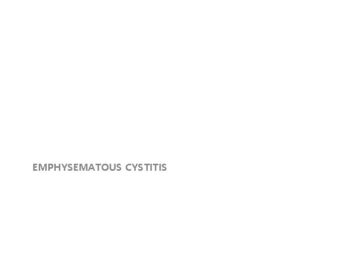 EMPHYSEMATOUS CYSTITIS 
