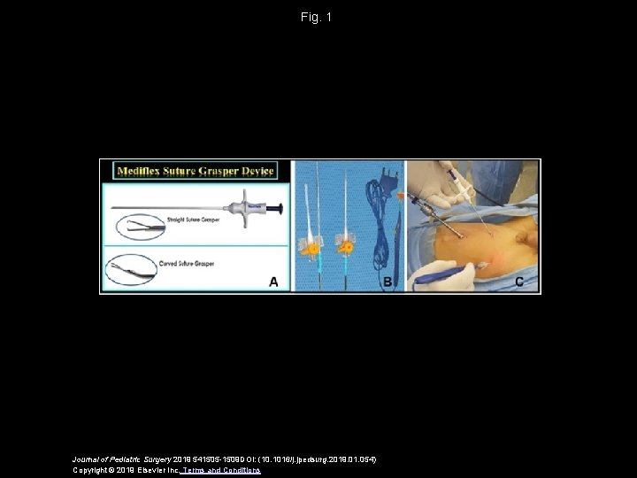 Fig. 1 Journal of Pediatric Surgery 2019 541505 -1509 DOI: (10. 1016/j. jpedsurg. 2019.