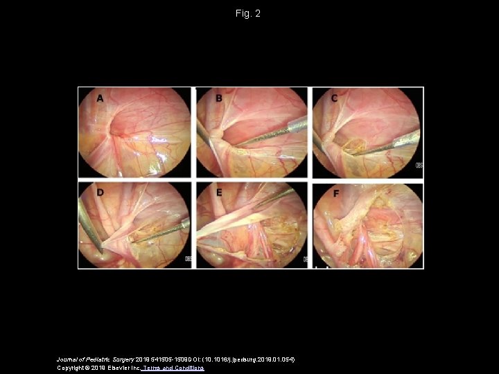 Fig. 2 Journal of Pediatric Surgery 2019 541505 -1509 DOI: (10. 1016/j. jpedsurg. 2019.