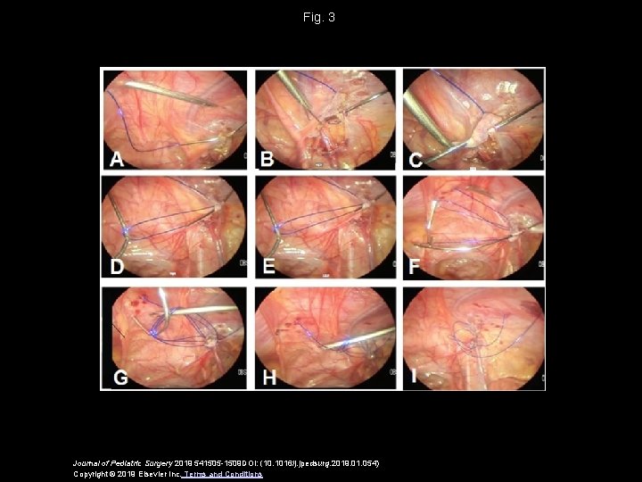 Fig. 3 Journal of Pediatric Surgery 2019 541505 -1509 DOI: (10. 1016/j. jpedsurg. 2019.