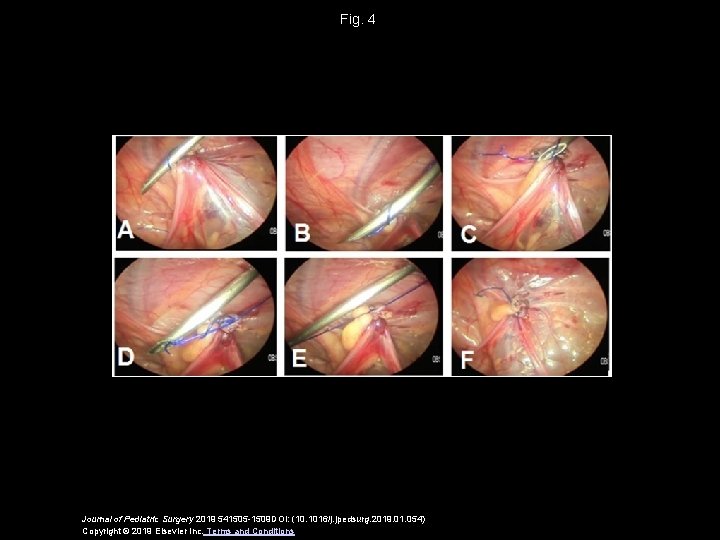 Fig. 4 Journal of Pediatric Surgery 2019 541505 -1509 DOI: (10. 1016/j. jpedsurg. 2019.