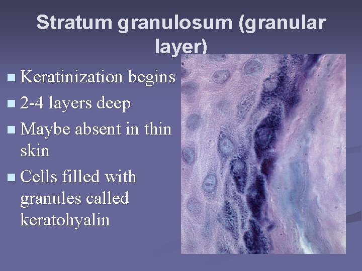 Stratum granulosum (granular layer) n Keratinization begins n 2 -4 layers deep n Maybe