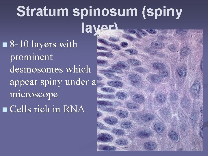 Stratum spinosum (spiny layer) n 8 -10 layers with prominent desmosomes which appear spiny