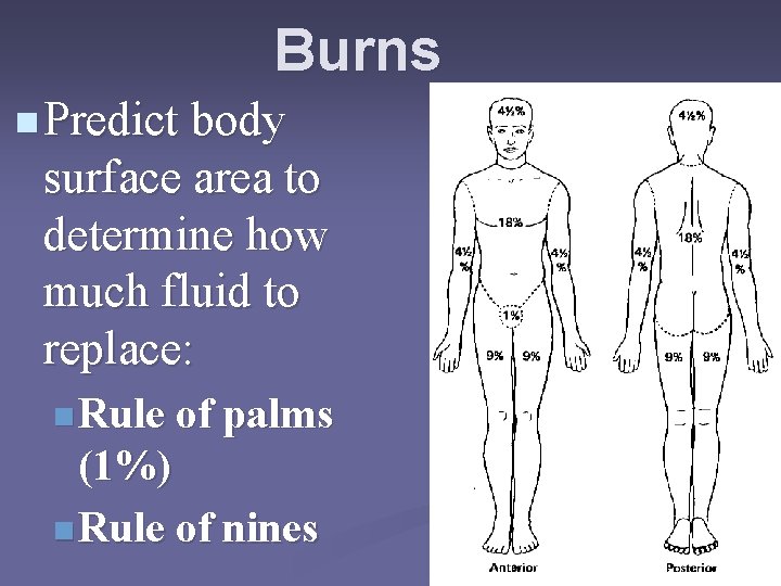 Burns n Predict body surface area to determine how much fluid to replace: n