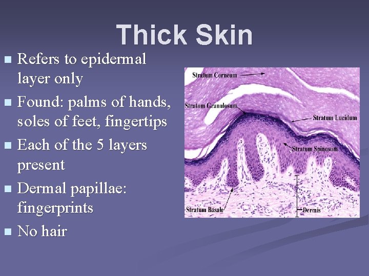 Thick Skin Refers to epidermal layer only n Found: palms of hands, soles of