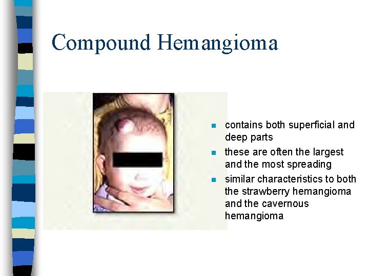 Compound Hemangioma n n n contains both superficial and deep parts these are often