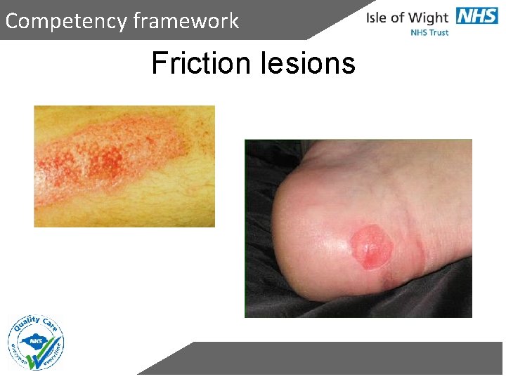 Competency framework Friction lesions 