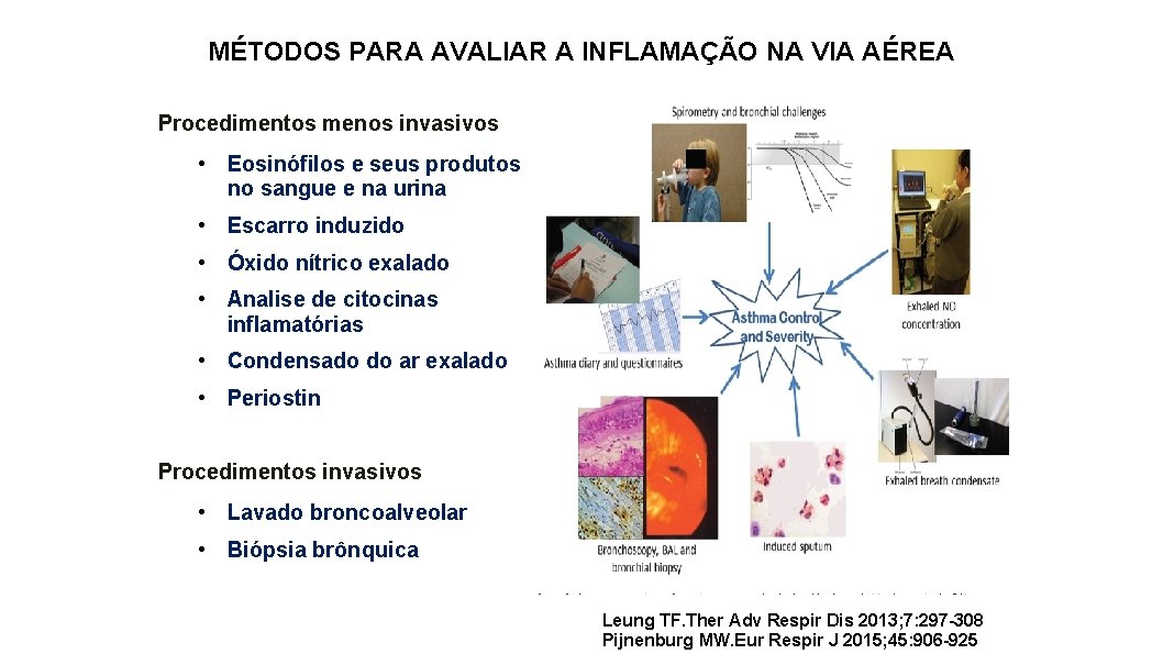 MÉTODOS PARA AVALIAR A INFLAMAÇÃO NA VIA AÉREA Procedimentos menos invasivos • Eosinófilos e