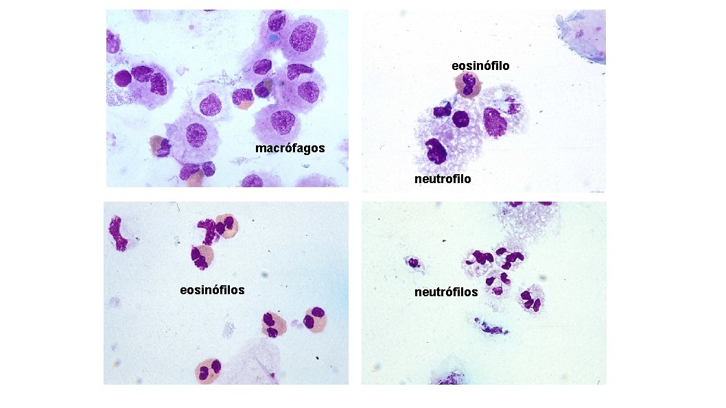 eosinófilo macrófagos neutrofilo Macr eosinófilos Eos neutrófilos 