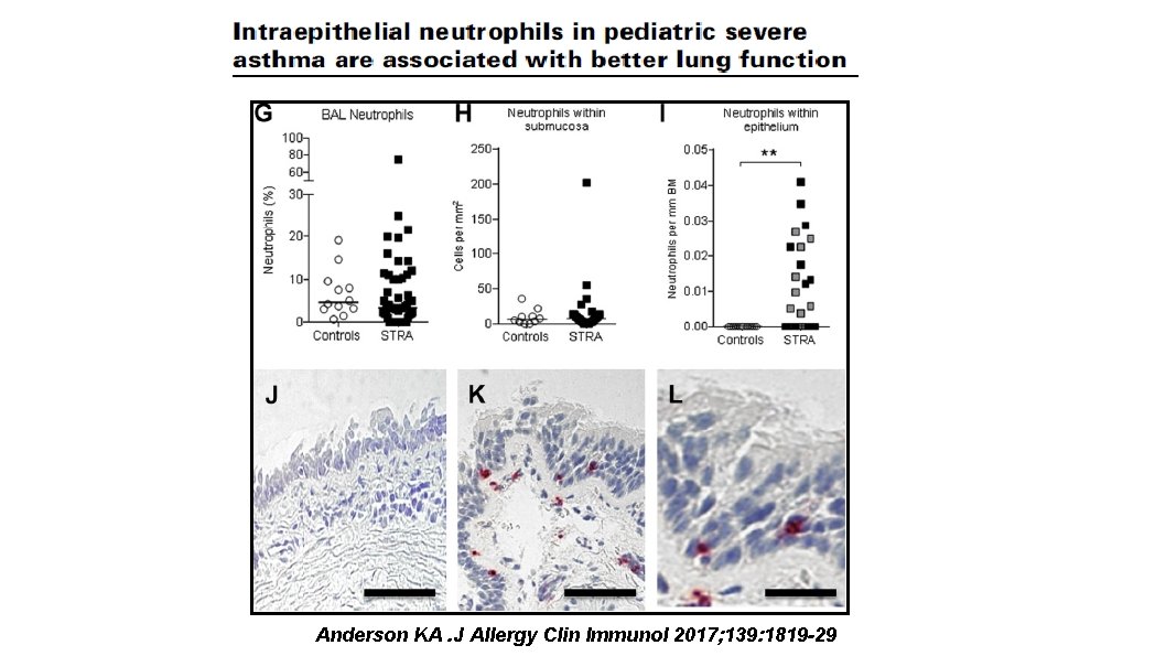 Anderson KA. J Allergy Clin Immunol 2017; 139: 1819 -29 