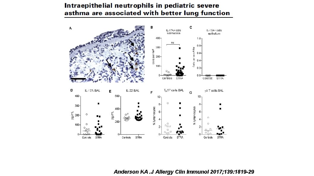 Anderson KA. J Allergy Clin Immunol 2017; 139: 1819 -29 