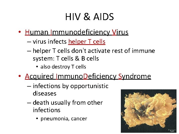 HIV & AIDS • Human Immunodeficiency Virus – virus infects helper T cells –