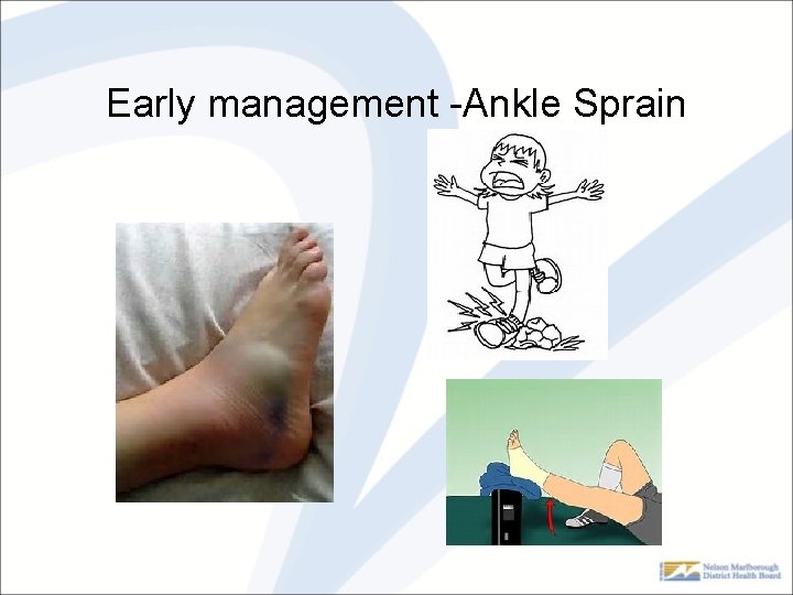 Early management -Ankle Sprain 