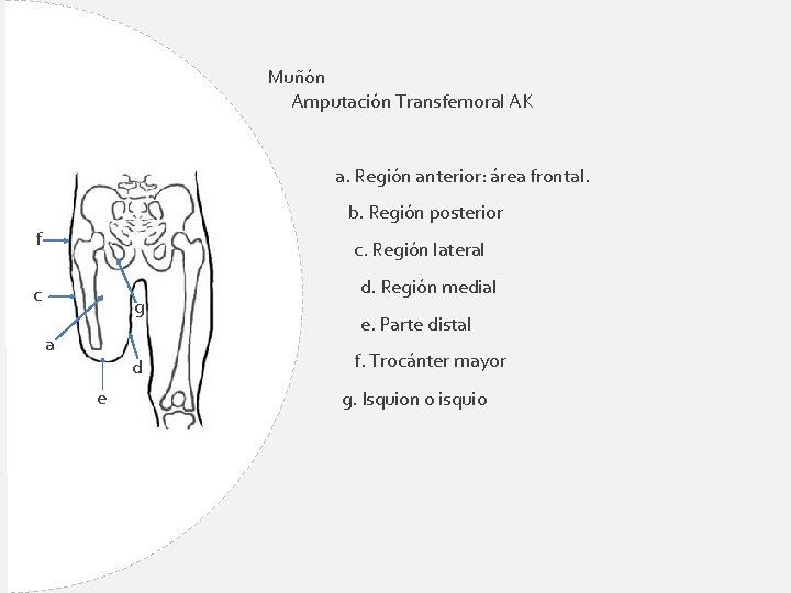 Muñón Amputación Transfemoral AK a. Región anterior: área frontal. b. Región posterior f c.