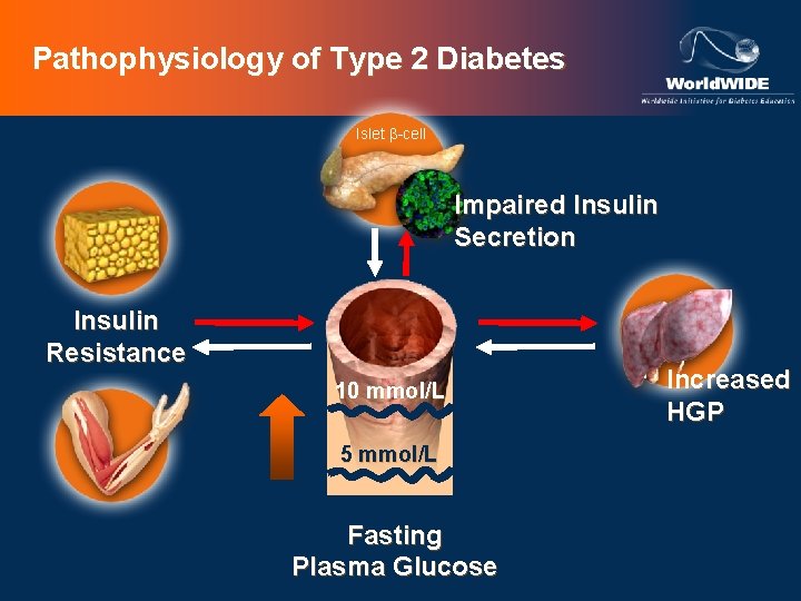 Pathophysiology of Type 2 Diabetes Islet b-cell Impaired Insulin Secretion Insulin Resistance 10 mmol/L