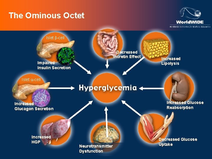 The Ominous Octet Islet b-cell Decreased Incretin Effect Impaired Insulin Secretion Increased Lipolysis Islet
