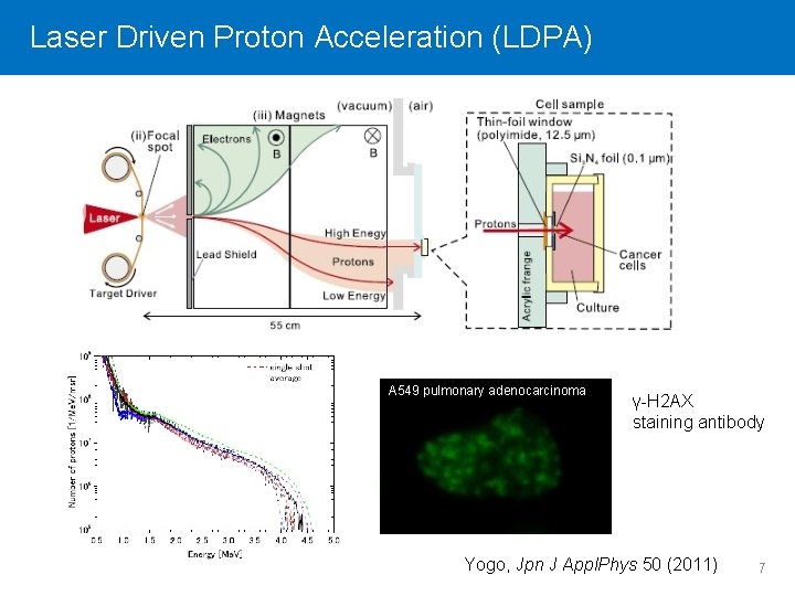 Laser Click to Driven edit Master Protontitle Acceleration style (LDPA) A 549 pulmonary adenocarcinoma