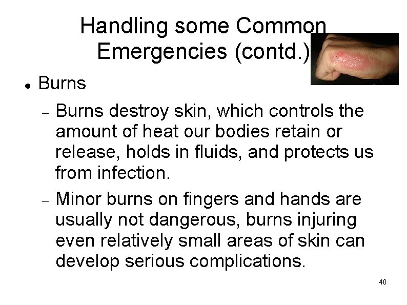 Handling some Common Emergencies (contd. ) Burns destroy skin, which controls the amount of