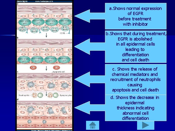 a. Shows normal expression of EGFR before treatment with inhibitor b. Shows that during