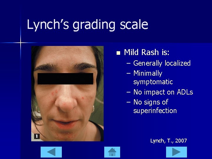 Lynch’s grading scale n Mild Rash is: – Generally localized – Minimally symptomatic –
