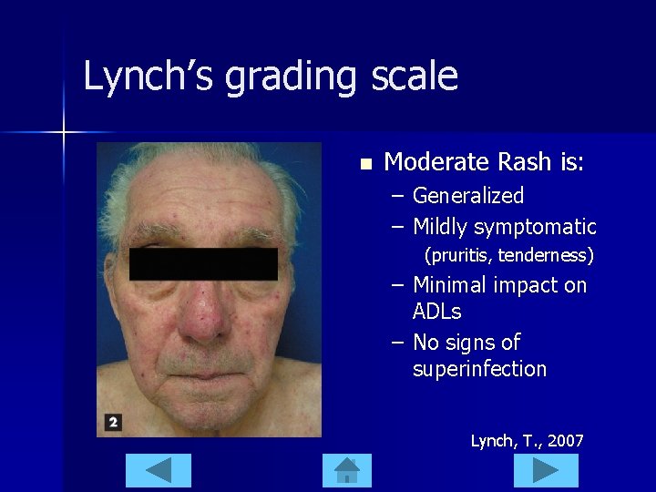 Lynch’s grading scale n Moderate Rash is: – Generalized – Mildly symptomatic (pruritis, tenderness)