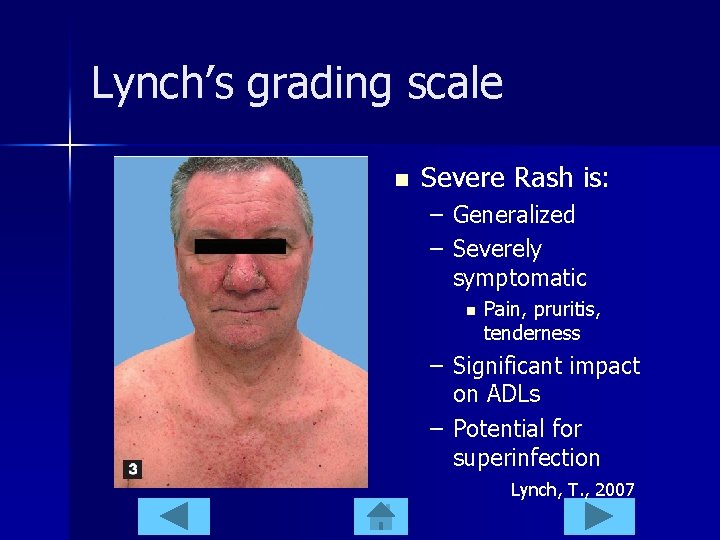 Lynch’s grading scale n Severe Rash is: – Generalized – Severely symptomatic n Pain,
