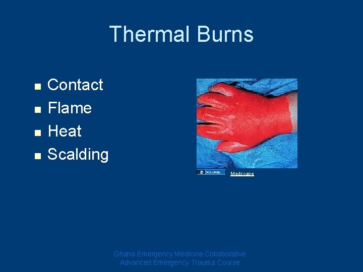 Thermal Burns n n Contact Flame Heat Scalding Medscape Ghana Emergency Medicine Collaborative Advanced