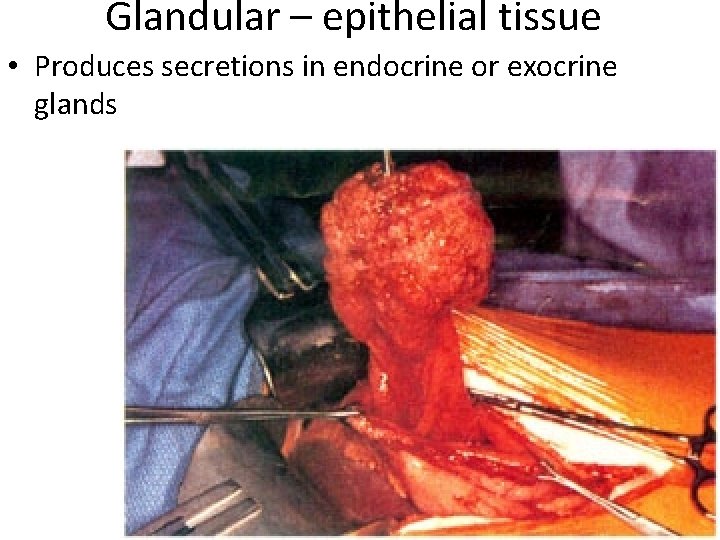 Glandular – epithelial tissue • Produces secretions in endocrine or exocrine glands 