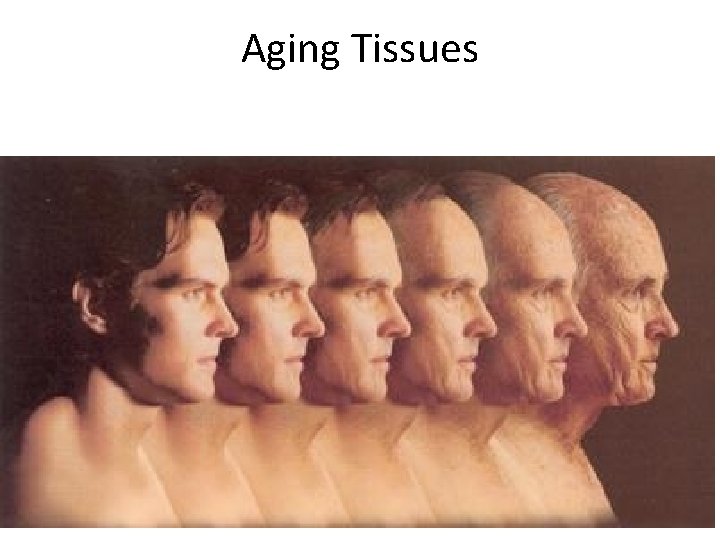 Aging Tissues 