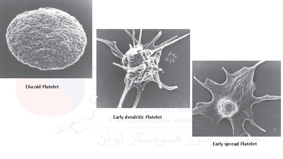 Discoid Platelet Early dendritic Platelet Early spread Platelet 