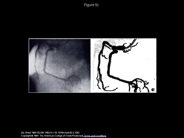 Figure 5 c Dis Chest 1967 52125 -140 DOI: (10. 1378/chest. 52. 2. 125)