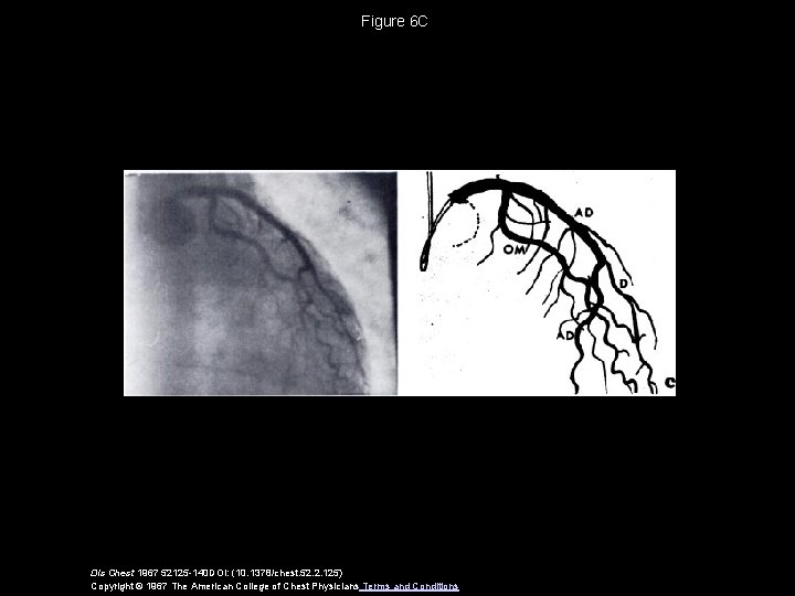 Figure 6 C Dis Chest 1967 52125 -140 DOI: (10. 1378/chest. 52. 2. 125)